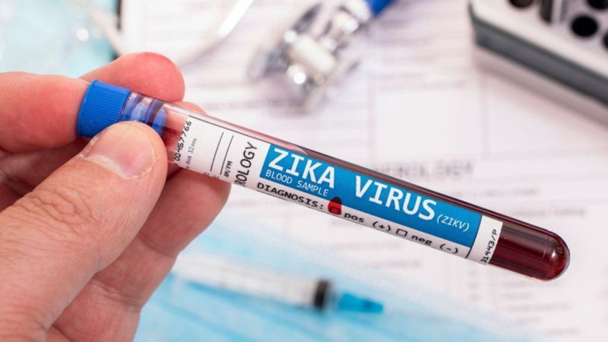 Study About Zika Vaccine